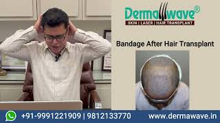 Hair Transplant Question To Ask Your Surgeon  How To Choose Hair Transplant Surgeon [upl. by Bishop]