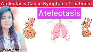 Atelectasis Cause Symptom Diagnose Treatment Hindi  What is Atelectasis  Atelectasis Cause Symptom [upl. by Heyra]