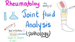 Joint fluid analysis Pathology  Joint Aspiration  Rheumatology [upl. by Otina]