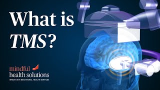 What is TMS How TMS works and treats depression [upl. by Doowrehs]