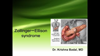 Zollinger Ellison syndrome [upl. by Ayhtak]