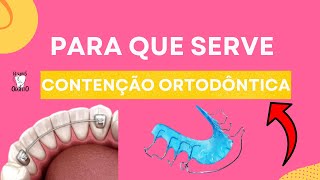 Para que serve contenção ortodôntica   Resumos de Odonto [upl. by Aseiram808]