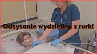 Odsysanie wydzieliny z rurki tracheostomijnej oraz jamy ustnej pacjenta [upl. by Woothen767]