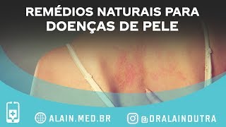 Remédios naturais para doenças de pele que funcionam [upl. by Odareg447]