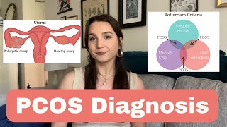 I was diagnosed with PCOS Where do I go from here [upl. by Cilo257]