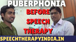 SLP Sanjay Kumar Before Puberphonia  8 Days  Speech Therapy  Diplophonia  A Voice Disorder [upl. by Arnaud]