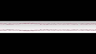 SND  Atavism tracks 8 9 10 [upl. by Canfield]