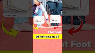 😱पैरों का एसे रखे ख्याल💕💯❤️ shorts viralvideo [upl. by Nilad]