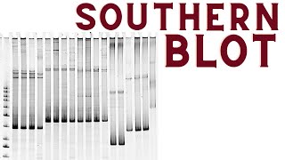 Southern blot  Southern blotting technique explained [upl. by Nylsirk116]