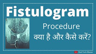 Fistulogram Radiological procedure Full detailed Hindi English [upl. by Tai621]