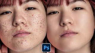 Face Retouching  Best Photoshop Tutorial  Skin Retouching 2023 [upl. by Major984]