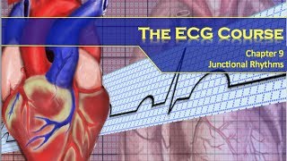 The ECG Course  Junctional Rhythms [upl. by Stalk]