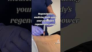 Regenerative medicine heals using your own bodys regenerative power [upl. by Woothen299]