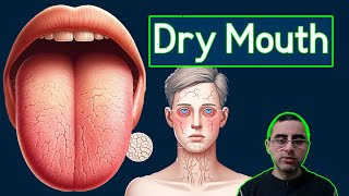 Top 7 Causes of Dry Mouth Xerostomia and Treatment [upl. by Aninaig]