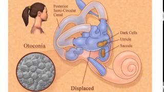 Fisiopatologia do Sistema Vestibular [upl. by Aramit817]