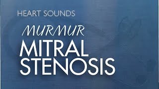 Mitral Stenosis Murmur  With Murmur Sounds Audio [upl. by Vel]