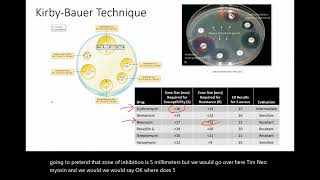 Kirby Bauer Testing for Drug Susceptibility [upl. by Nosyerg923]