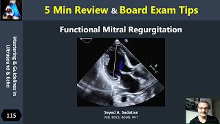 5 Min Review  Functional Mitral Regurgitation [upl. by Killion]