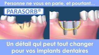 Implant dentaire  Comblement postextraction Parasorb [upl. by Sauer]