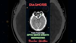 Radiology  CT Findings  High Yield MCQs  NEET PG  INICET  MRB  PYQs inicet [upl. by Wiles246]