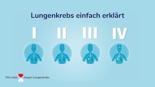 Lungenkrebs – Die verschiedenen Stadien [upl. by Delbert]