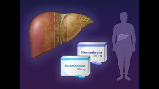 Resmetirom for NASH with Liver Fibrosis  NEJM [upl. by Abbottson115]