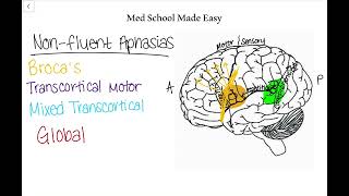 NonFluent Aphasias Made Easy How to Distinguish and Remember Them [upl. by Joash]