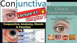 🔴 Conjuctiva Clinical Ophthalmology Lecture1 conjuctivitis classification of conjunctivitis [upl. by Claud]