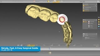 inLab SW 18 Simple Fast amp Easy Surgical Guide [upl. by Ahseenak933]