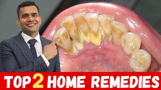 Top 2 Remedies To Remove Dental Plaque  Remove Dental Plaque and keep Oral Hygiene Healthy At Home [upl. by Aimaj]