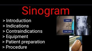 Sinogram  indication  Contraindications procedure Complete study  by BL Kumawat [upl. by Eanom]