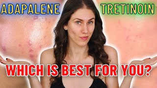 Adapalene vs Tretinoin  Which Is The Best ANTIACNE and ANTIAGING Ingredient [upl. by Elo7]