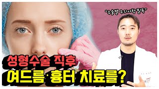 성형수술 직후에 여드름 흉터 시술 바로 가능할까 필러· 보톡스 포함 [upl. by Asertal]