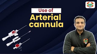 Use of Arterial cannula  DAMS Nursing [upl. by Elane818]