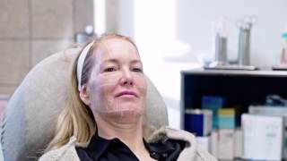 Ultherapy® München  UltraschallLifting bei Dr Tatjana Pavicic [upl. by Renell761]