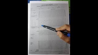 How to fill a partogram [upl. by Antebi891]