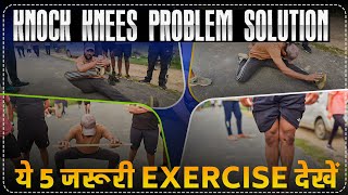 SSC GD Medical Knock Knees Problem Soution Exercises How to Cure Knock Knees  rojgarwithankit rwa [upl. by Strawn926]