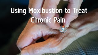 Using moxibustion to treat chronic pain [upl. by Redla]