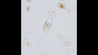 Testate amoeba under the microscope [upl. by Seraphine547]