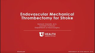 Endovascular Mechanical Thrombectomy for Stroke [upl. by Meyer]