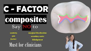 C Factor in dental composites [upl. by Joann694]