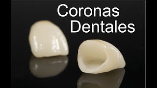 CORONAS DENTALES SOBRE IMPLANTES  PRODENT  MEDICINA EXTRAORDINARIA [upl. by Aimehs406]