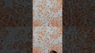 Blood cells under microscope macroscopic youtubeshorts shorts ytshorts [upl. by Eah]