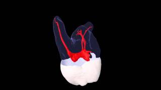 Maxillary First Molar 3D Image [upl. by Meldoh804]