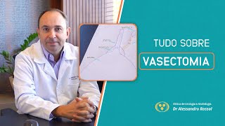 VASECTOMIA  DR ALESSANDRO ROSSOL [upl. by Leahcimnaes]