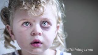 Recognition of Child Abuse and Neglect Training Video [upl. by Engeddi]