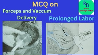 MCQ on Forceps deliveryVacuum delivery and Prolonged Labor RB MCQ Bank Knowledge Booster [upl. by Anilram]