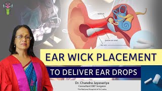 Ear Wick Placement to Deliver Ear Drops  Dr Chandra Jayasuriya EarNoseThroat [upl. by My]