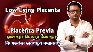 Low Lying Placenta  Placenta Previa কি  কেন হয় কিভাবে ঠিক হয় হলে কি করবেন  The Bong Parenting [upl. by Eerehc]