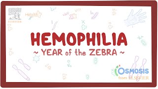 Hemophilia Year of the Zebra [upl. by Heshum]